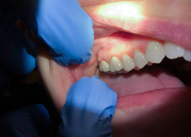 Best Pediatric Emergency Dentist in Dunlap, IA